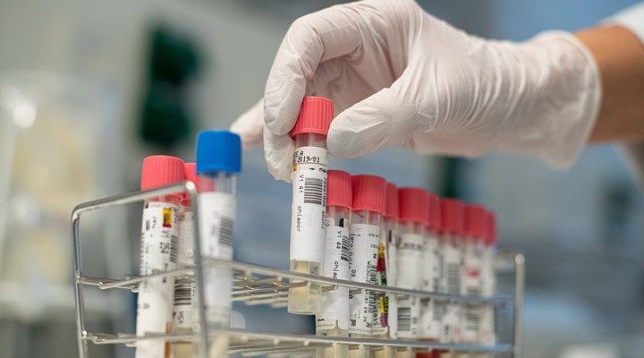 Azərbaycanda koronavirus ilə bağlı son vəziyyət açıqlandı